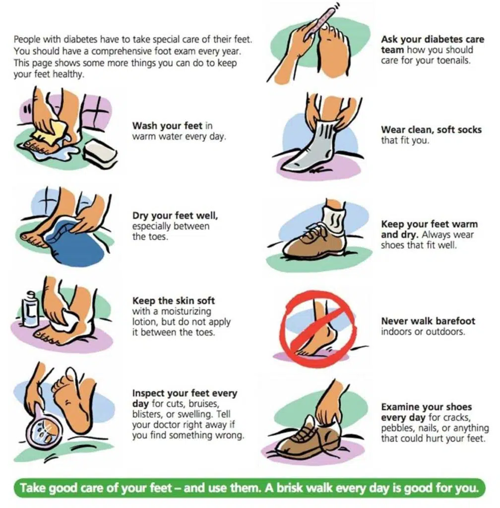 Tips for how to care for diabetic feet.